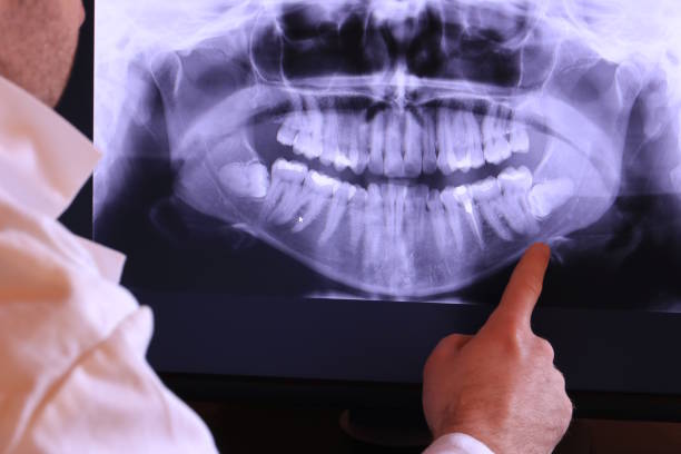 Best Emergency Dentist for Knocked-Out Tooth in Cascade Valley, WA