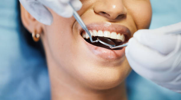 Best Emergency Dental Services for Seniors in Cascade Valley, WA